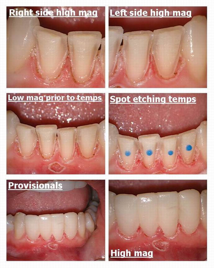 Resize of Lower Anterior pg 3.jpg